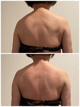 クレビア(CRE'BIA)/肩こり