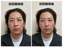 トータルバランス整体院 &nbsp;オレンジ(ORANGE)/顎関節矯正/アゴの痛み/顔の歪み