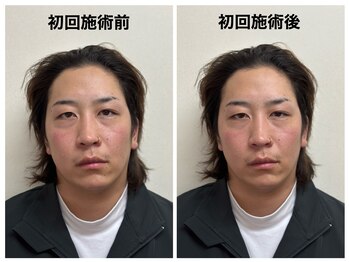 トータルバランス整体院 &nbsp;オレンジ(ORANGE)/顎関節矯正/アゴの痛み/顔の歪み