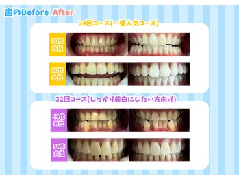 ドルチェ 水戸店(Dolce)/コース別☆Before After