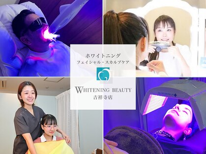 ホワイトニングビューティー 吉祥寺店の写真