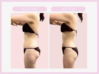 スリムライン 盛岡店(The Slim Line)/before→after