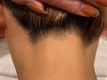 ファビー(Fabby)の写真/うなじ美人で後ろ姿に差をつけたい方におすすめ♪うなじだけでなく顔まわりもワントーン明るく第一印象UP!