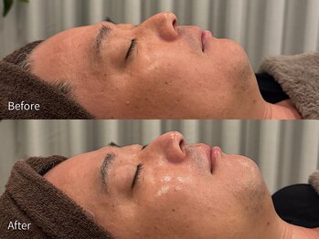 アウラ 小杉店(AULA)/