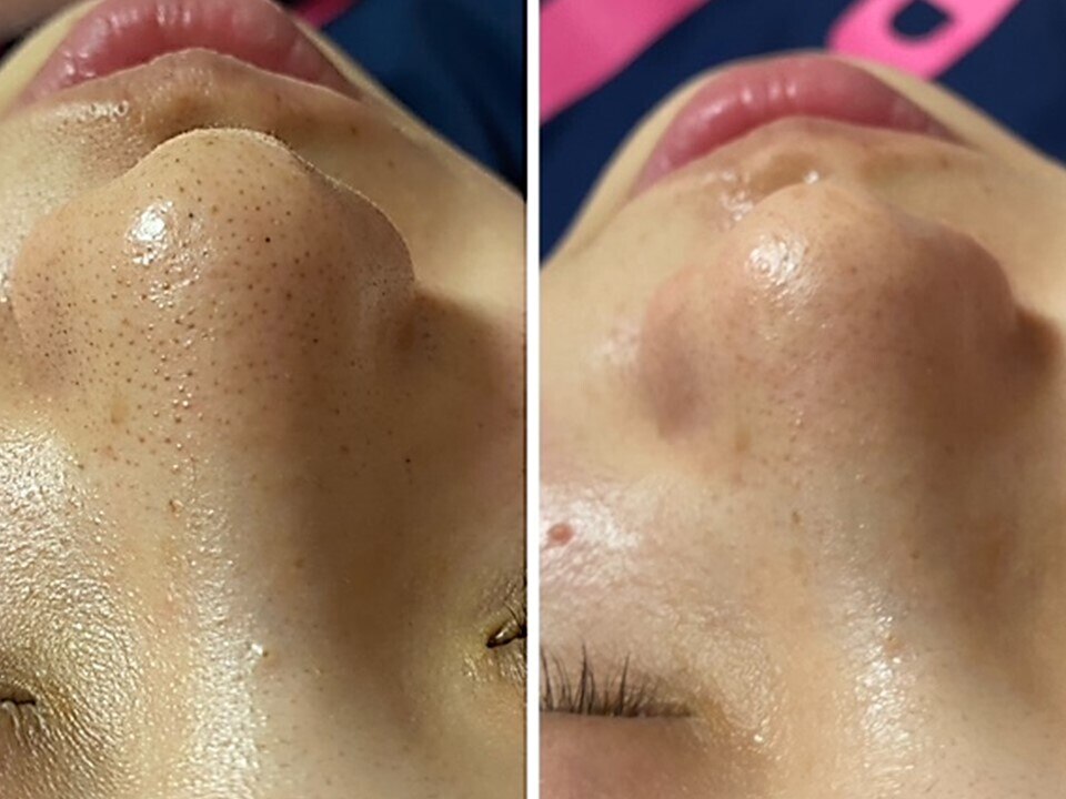 エステティック 華｜ホットペッパービューティー