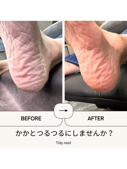 ティディーネスト(Tidynest)/かかとケア