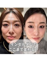 フレル(FUREL)/辿り着いたのは次世代スキンケア