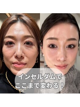フレル(FUREL)/辿り着いたのは次世代スキンケア
