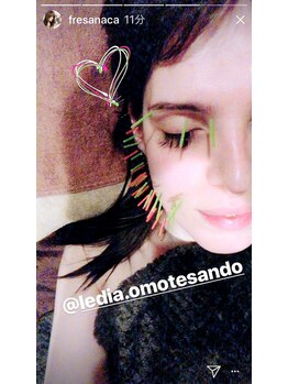 ルディア 堂島店(ledia)/大阪美容鍼 タレントIVAN様