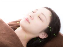 洪福寺松原の接骨院 はり灸院/大人気★美容鍼も導入！