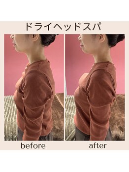 アルパカ(ALPAKA)/肩が軽いと心も軽い！