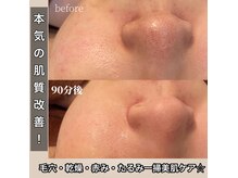 ワンブルーム(OneBloom)の雰囲気（肌質は人それぞれ。貴方に合う最適の肌ケアで別人級の素肌へ☆）