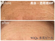 ルアナ(Luana)/【WiQoワイコ水光ピーリング】