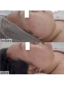 ヴェルシック(Belchic)/顎下も決して諦めない