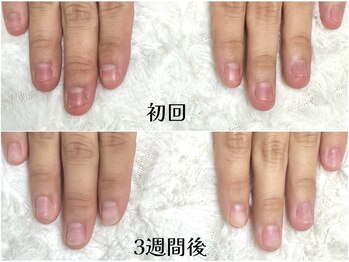 グラシナ 鳥丸店/自爪そっくり