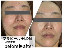 サロンスペース/40代女性【プラピール＋LDM】