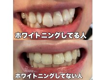 ホワイトサロンの雰囲気（自然な白さにしたい方向けのホワイトニングです）