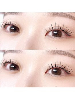 エティナル 上小田井(eternel)/&ヘルシー×フラット120本