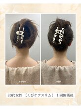 プレメ 人形町院(The Preme)/くびケアスリム　症例