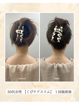 プレメ 人形町院(The Preme)/くびケアスリム　症例