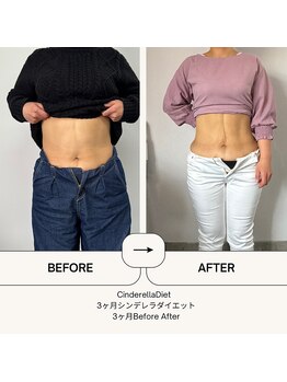 オーシャン整骨院(OCEAN整骨院)/３ヶ月ダイエットコース