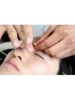 アスミルはり灸接骨院/紫外線が強くなる季節に!