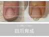 【爪にコンプレックスがある方】<10回コース> 自爪育成・深爪緩和1回8800円