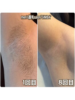 メンズ シンバ(SIMBA)/◯before→after◯