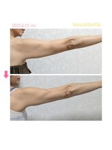 サロン ド 花歩 松山本店/痩せにくい「二の腕」もお任せ！