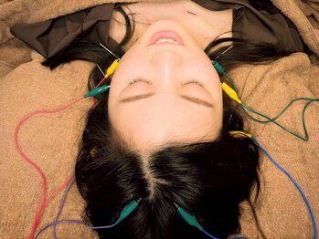 キュー 高槻(cue.)/美容鍼 45分 ¥5,500