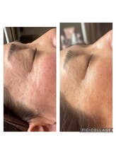 絢香/ビフォーアフター！！！