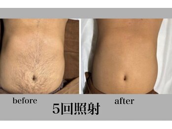 アンド エヌ(&n)/◆全身脱毛◆