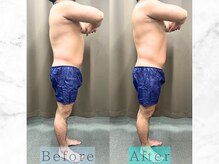 パラディ(PARADIS)/ハイパーナイフ/シェイプ