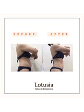 ルトゥーシア(Lotusia)/上半身　before→after