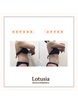 ルトゥーシア(Lotusia)/上半身　before→after