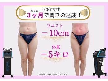 ベルフィーヌボーテ(BELFINE beaute)/痩身エステ90分