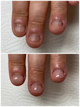 ココ ネイル サロン アンドスクール(COCO.NAIL SALON＆SCHOOL)/爪噛みケア