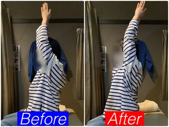 ナオル整体 仙台院(NAORU整体)/20代女性「肩こり 姿勢不良」