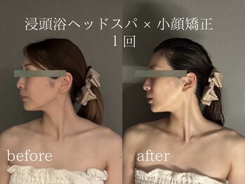 モンデュ(MonDue)/浸頭浴ヘッドスパ×小顔矯正１回