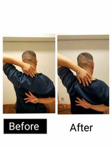 アース エンジェル整体院/ビフォアフ　肩甲骨はがし
