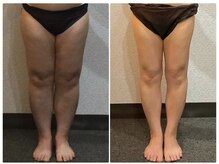 美容整体 ウェリナ 蟹江院/小顔矯正/骨盤矯正/美脚サロン