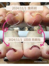 ブロックファイブハナ(Block 5 HANA)/