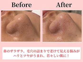 ココロ(COCORO)/美脳小顔矯正＆毛穴洗浄