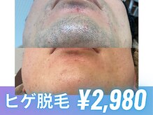 ハピネス 広島店(Happiness)