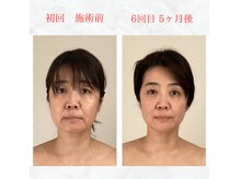 リラココ(リラcoco)