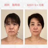 リラココ(リラcoco)