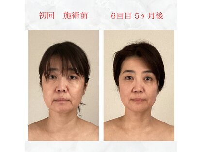 リラココ(リラcoco)の写真