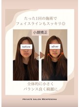 ムンプソナ(Mempesona)/一回で劇的変化！