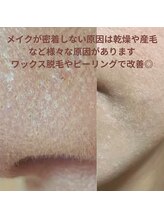 ソーヴ(SOLVE)/ピーリング/シェービング/毛穴