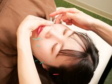 アネモネ 心斎橋院/ベーシック美容鍼灸２